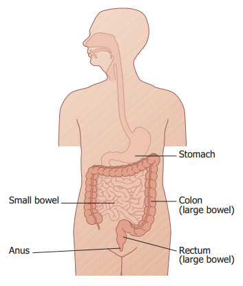 BowelCancer