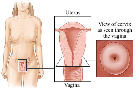 CervicalCancer